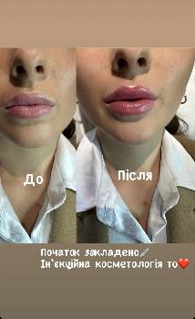 Фотографія підприємства №18